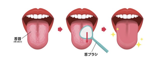 舌のお掃除