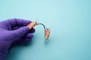 【歯科医が解説】はじめての部分入れ歯｜種類と特徴をわかりやすく紹介
