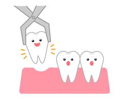 歯を抜いた後は？？