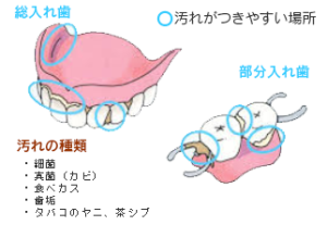 入れ歯の正しいお手入れ方法